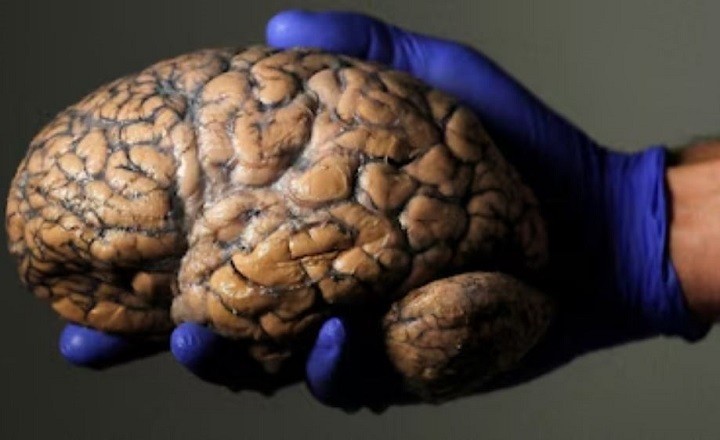 Penelitian Baru Menunjukkan Kedewasaan Dimulai Setelah Usia 32 Tahun, Ilmuwan Ungkap Lima Fase Otak Manusia